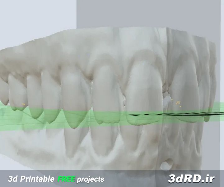 طرح آماده پرینتر سه بعدی ماکت دندان پایین