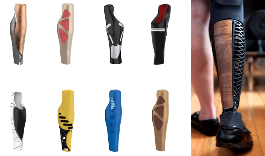ساخت روکش پای مصنوعی با پرینتر سه بعدی