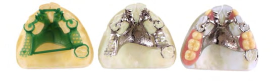 استفاده از نتایج اسكن دهان بيمار در ساخت مدل سه بعدی