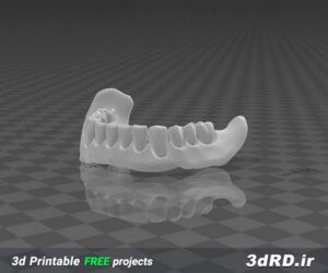 دانلود طرح سه بعدی پروتز دندون/ماکت دندون سه بعدی/پروتز فک پایین/پروتز سه بعدی