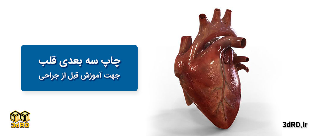 چاپ قلب برای آموزش قبل از جراحی توسط پرینتر سه بعدی